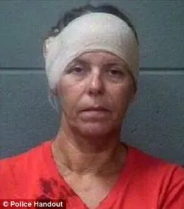 Woman is Arrested for “Malicious Castration” after causing Permanent Injury by biting her Boyfriend’s Scrotum ~ Call